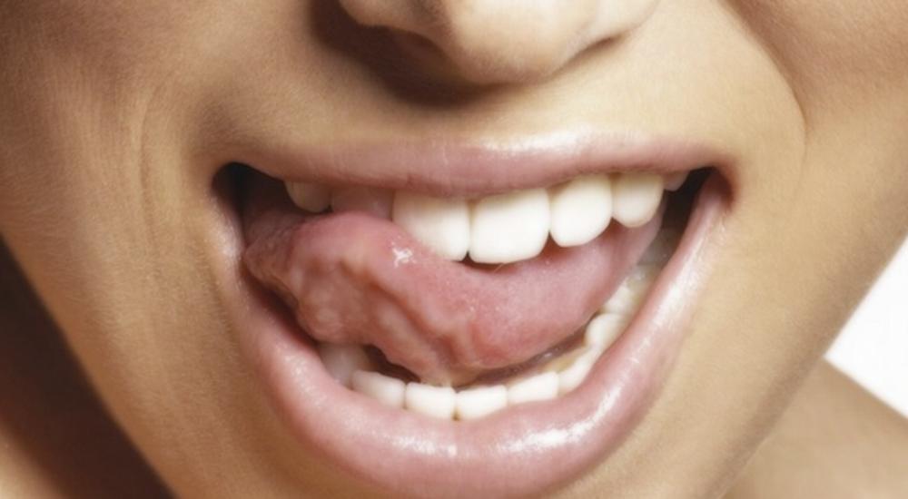 30 TONGUE.jpg